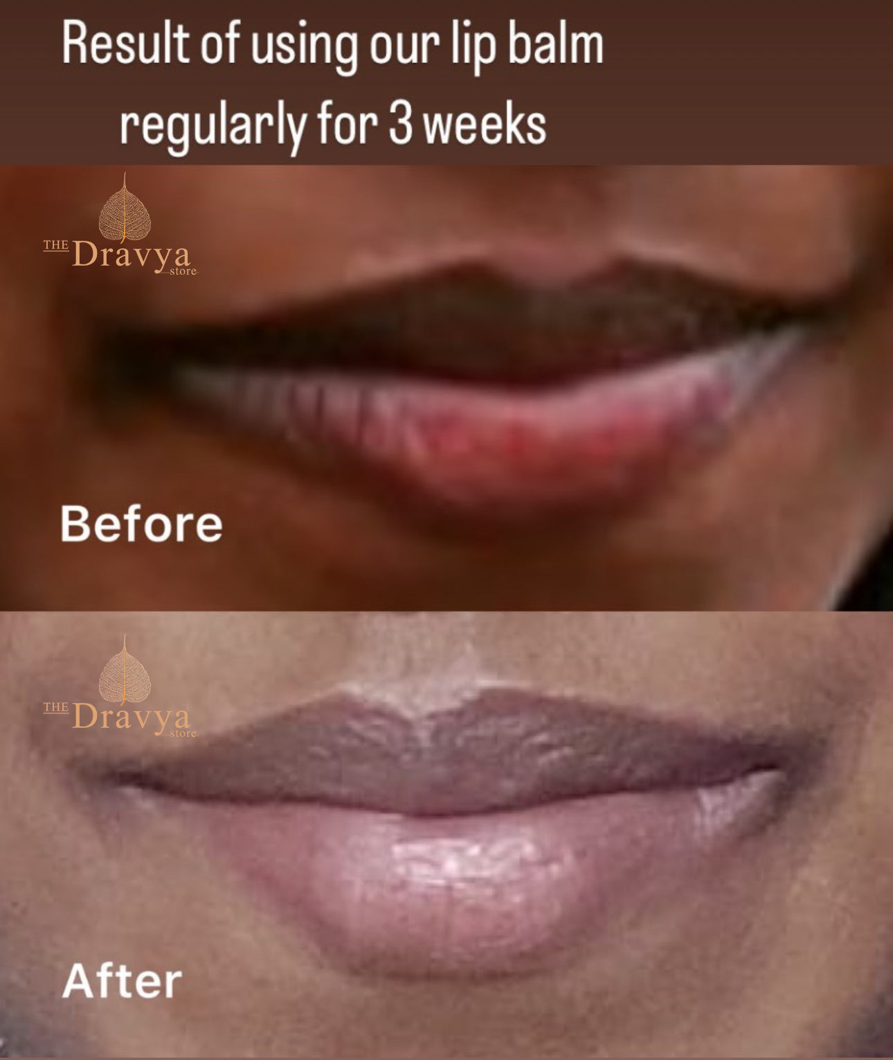 Nourishing Rose Lip Balm - A solution for pigmented and dry lips