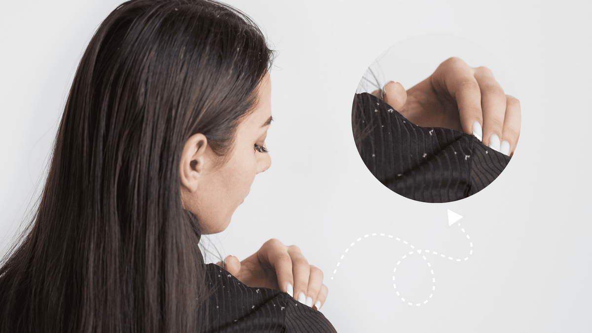 Your guide to a healthy and Dandruff-free scalp