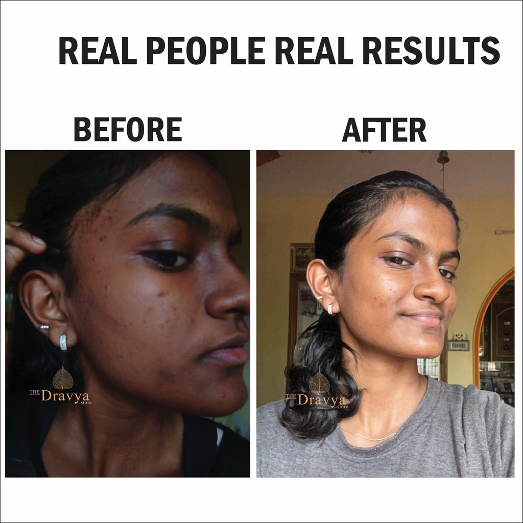 14. ⁠Blue Magic - for Brightening and hydrating skin