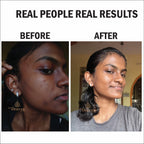 14. ⁠Blue Magic - for Brightening and hydrating skin