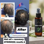 ⁠Pure Rosemary Hydrosol – Scalp & Hair Tonic |Promotes Healthy-Looking Hair