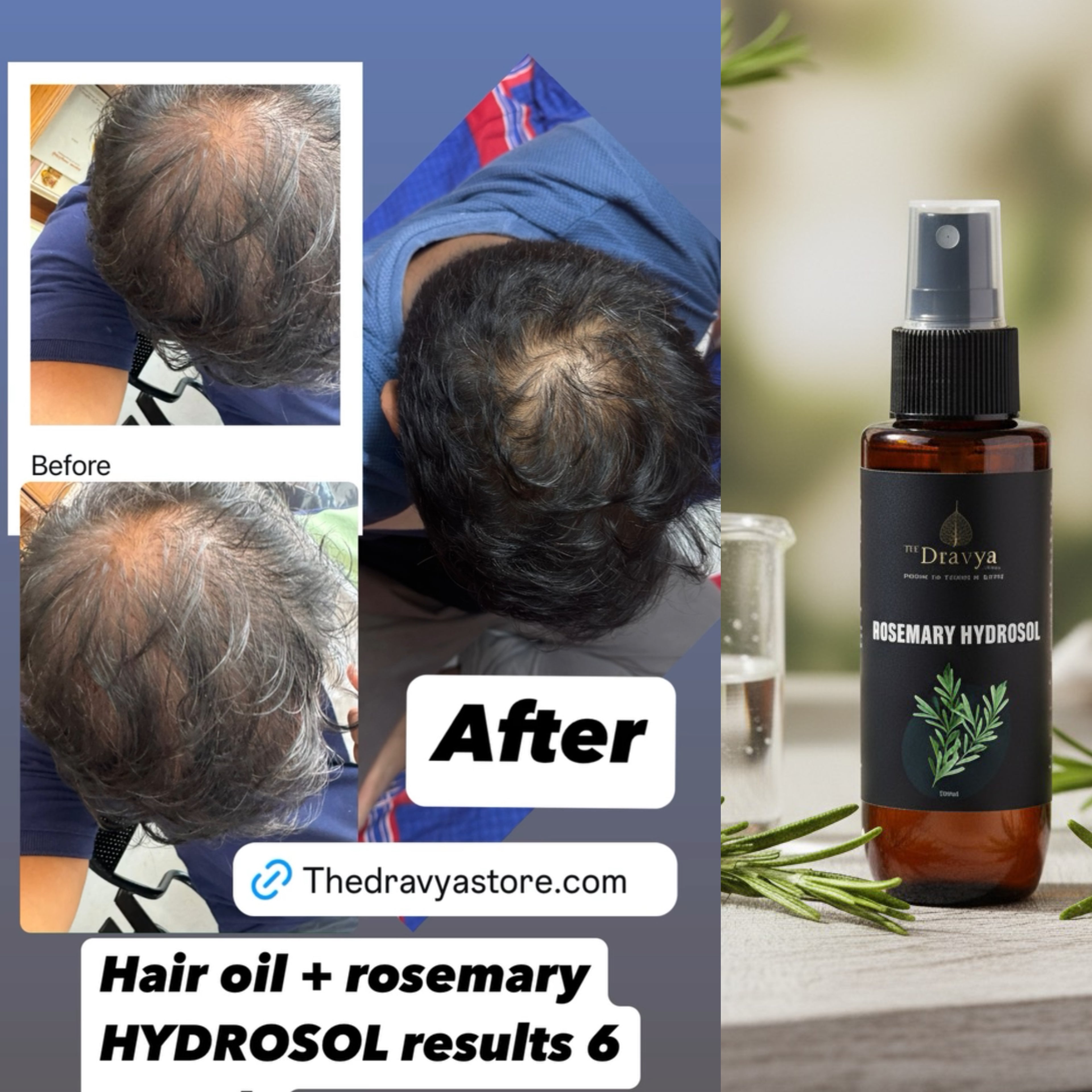 ⁠Pure Rosemary Hydrosol – Scalp & Hair Tonic |Promotes Healthy-Looking Hair