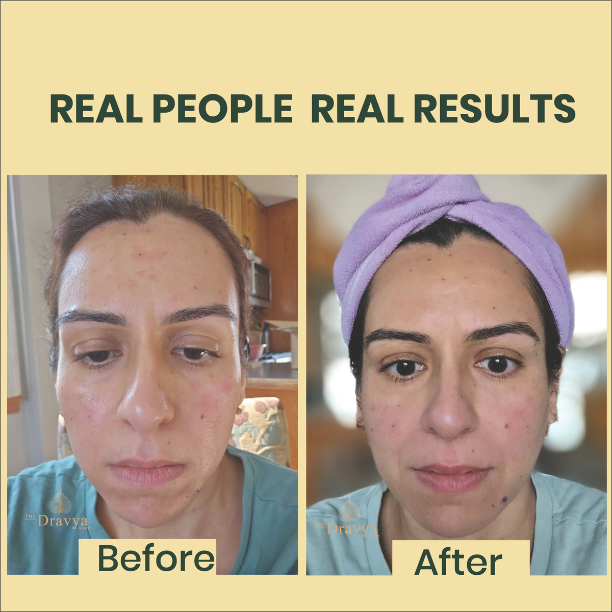 DRAVYA Kumkumadi Thailam – Ayurvedic Radiance & Even-Tone Facial Oil | Fading dark spots, sun tan and pigmentation