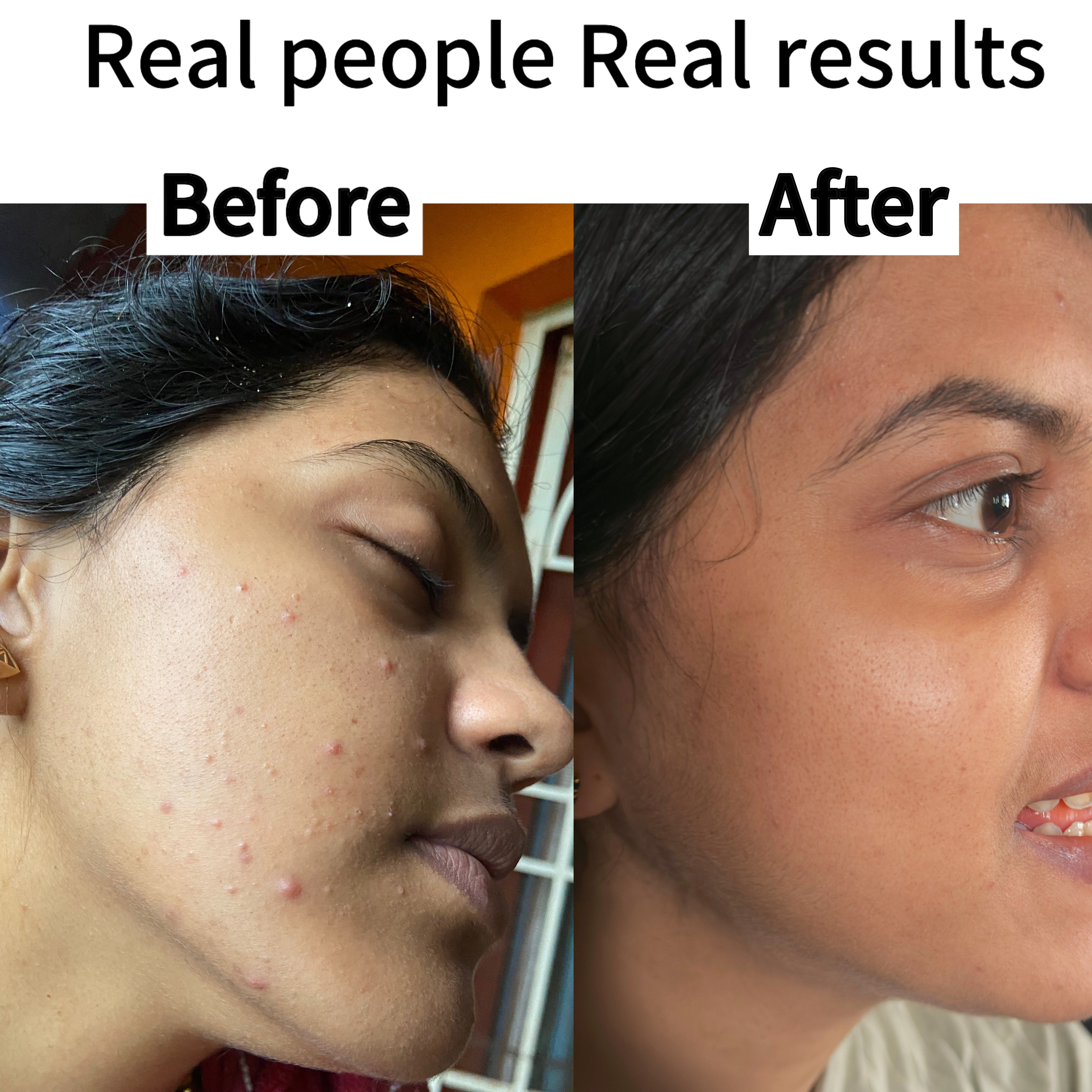 Kumkumadi tailam – Radiant glow, Tan Removal & Age-Defying face oil