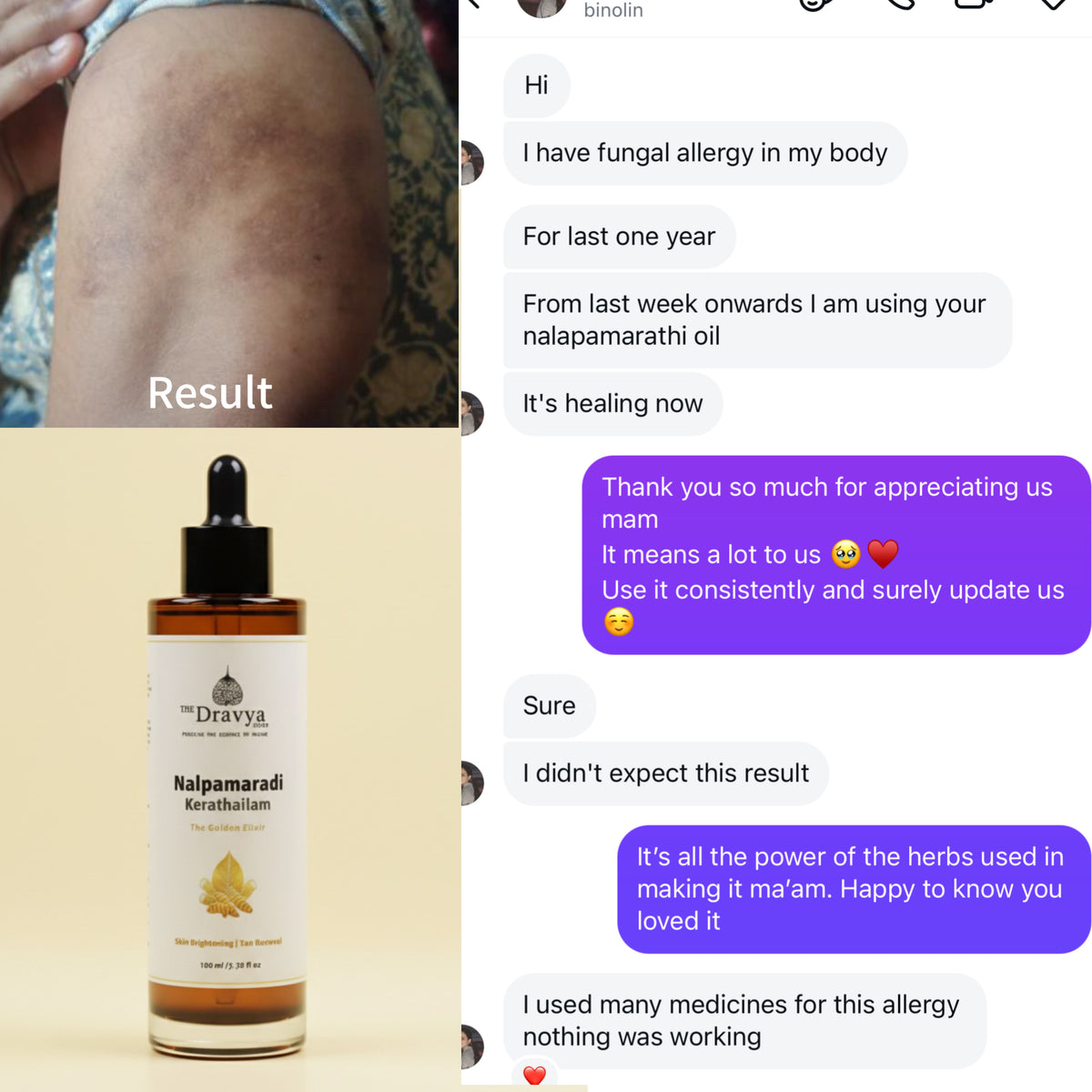 DRAVYA Nalpamaradi Keratailam - 
Ayurvedic Brightening & De-Tan Face & Body Oil | Clinically-inspired Ayurvedic formulation used for centuries