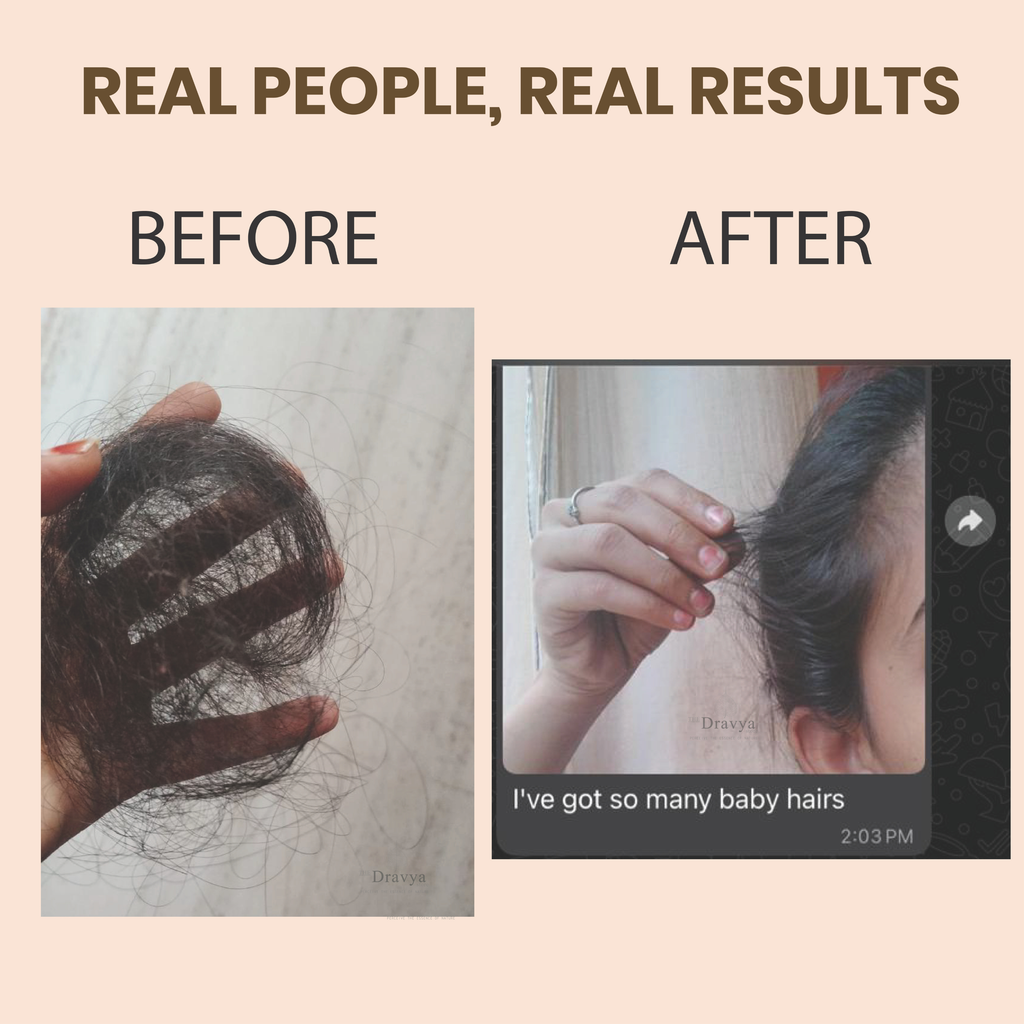 Kesha Raksha Ayurvedic Hair Oil - made with 49 herbs - for healthy scalp and strong hair