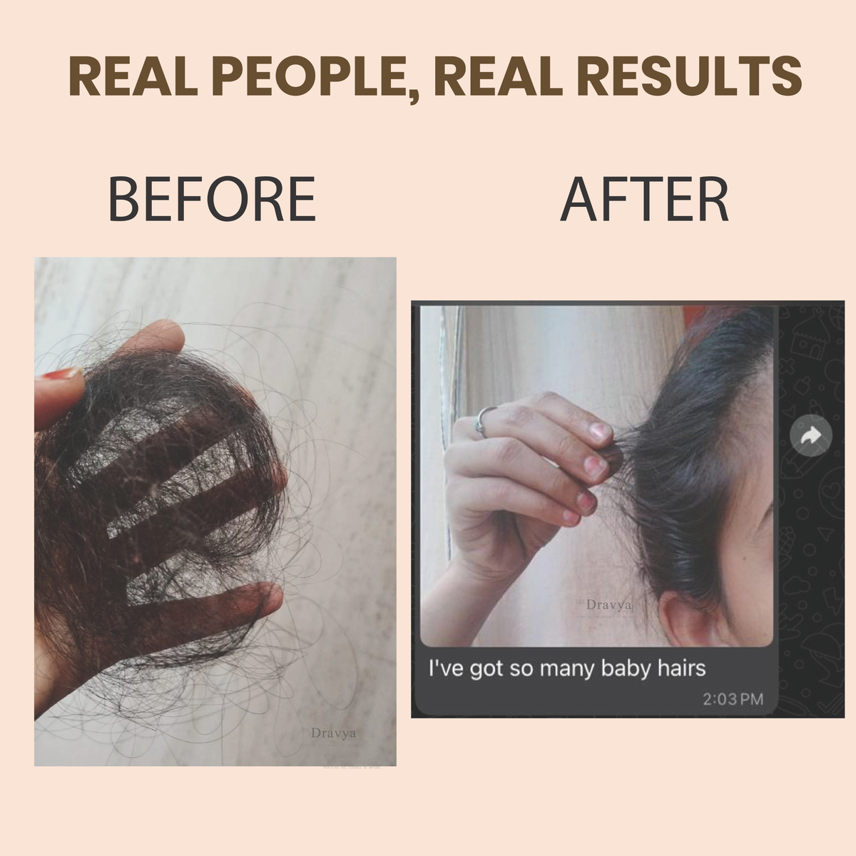 DRAVYA™ Kesha Raksha _
49-Herb Ayurvedic Hair Revival Oil