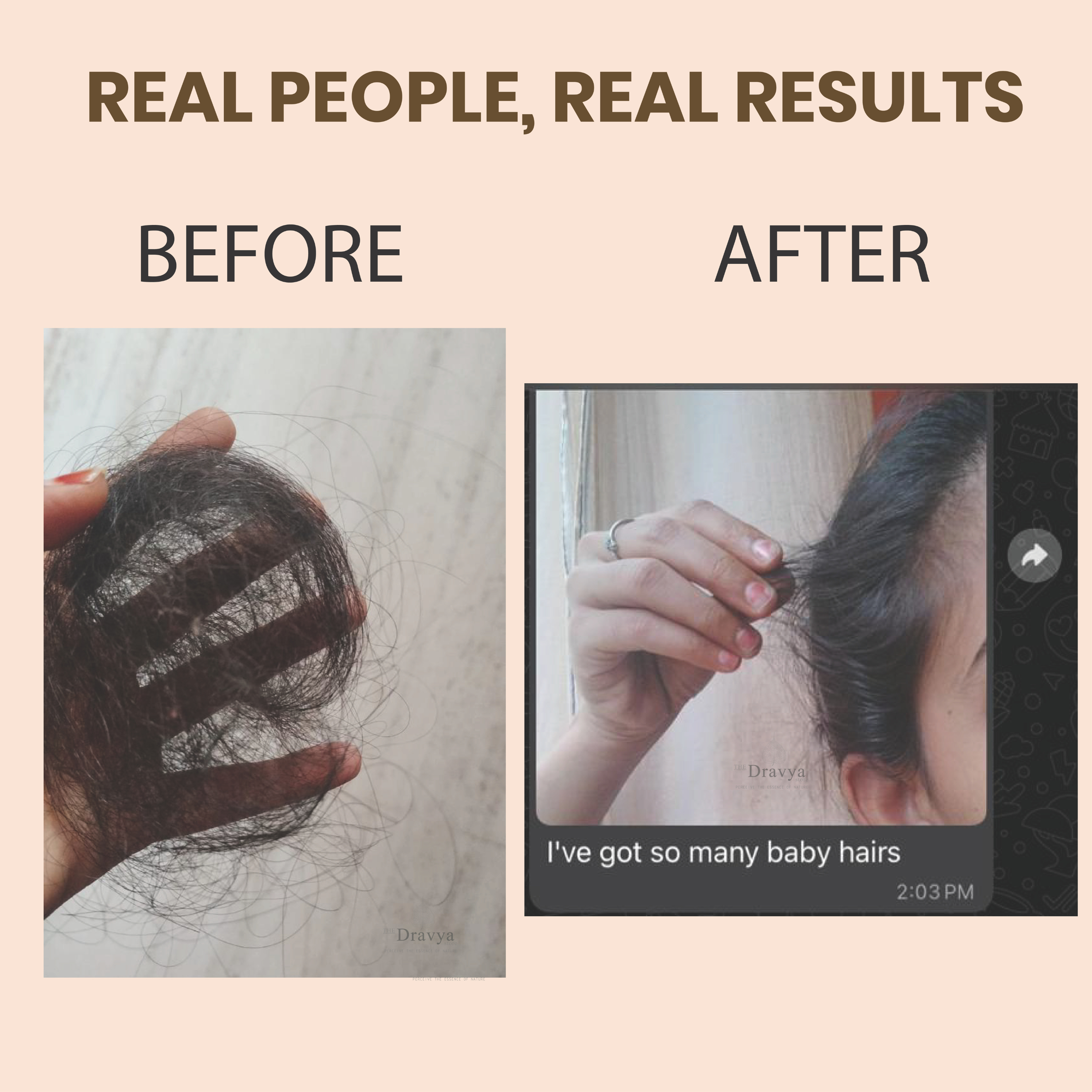 Kesha Raksha Ayurvedic Hair Oil - made with 49 herbs - for healthy scalp and strong hair