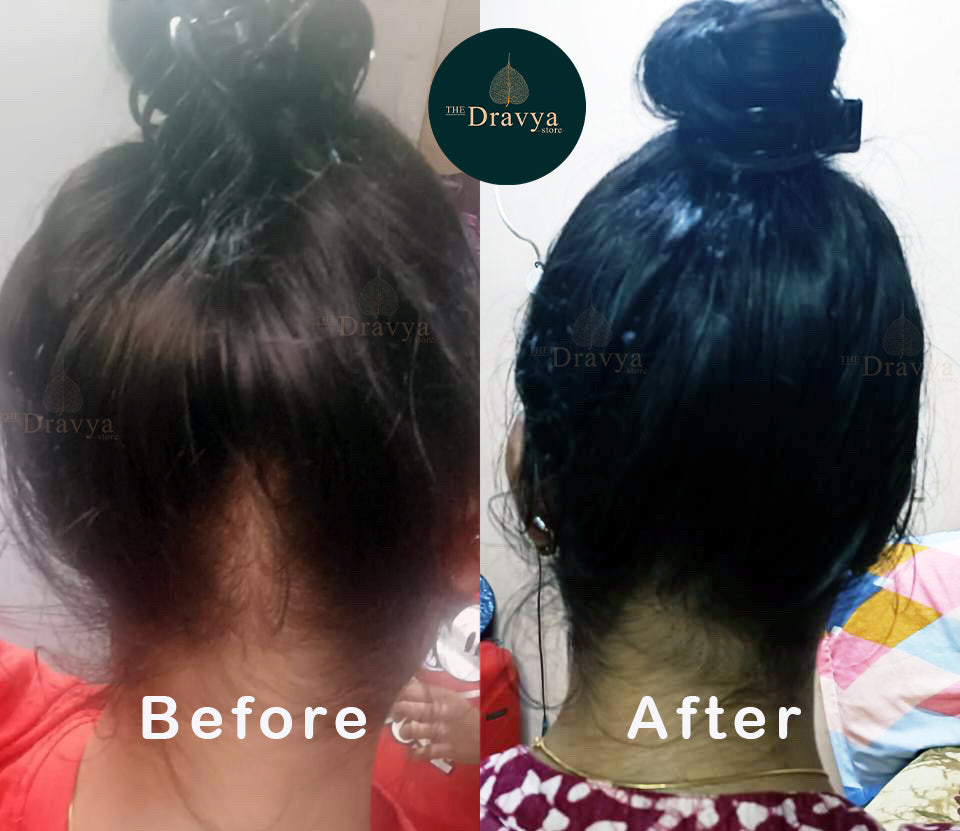 DRAVYA™ Kesha Raksha _
49-Herb Ayurvedic Hair Revival Oil