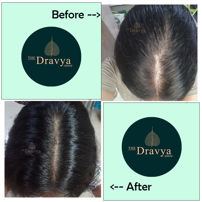 DRAVYA™ Kesha Raksha _
49-Herb Ayurvedic Hair Revival Oil
