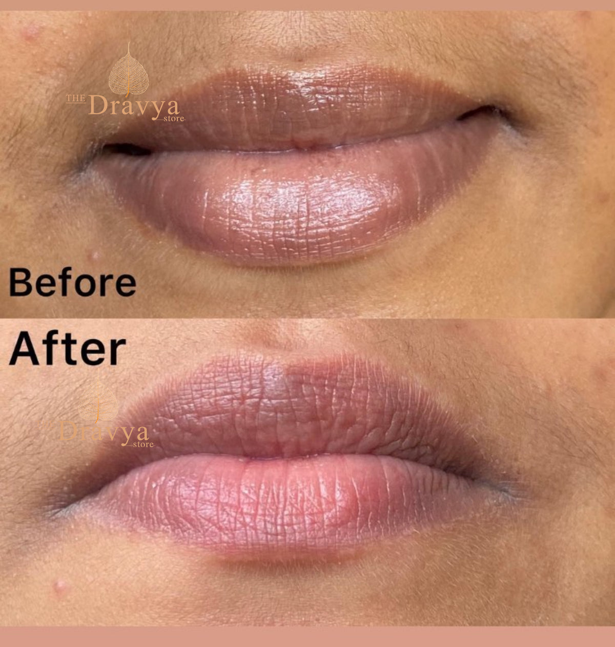 Rose Lip Balm - pigmented and dry lips