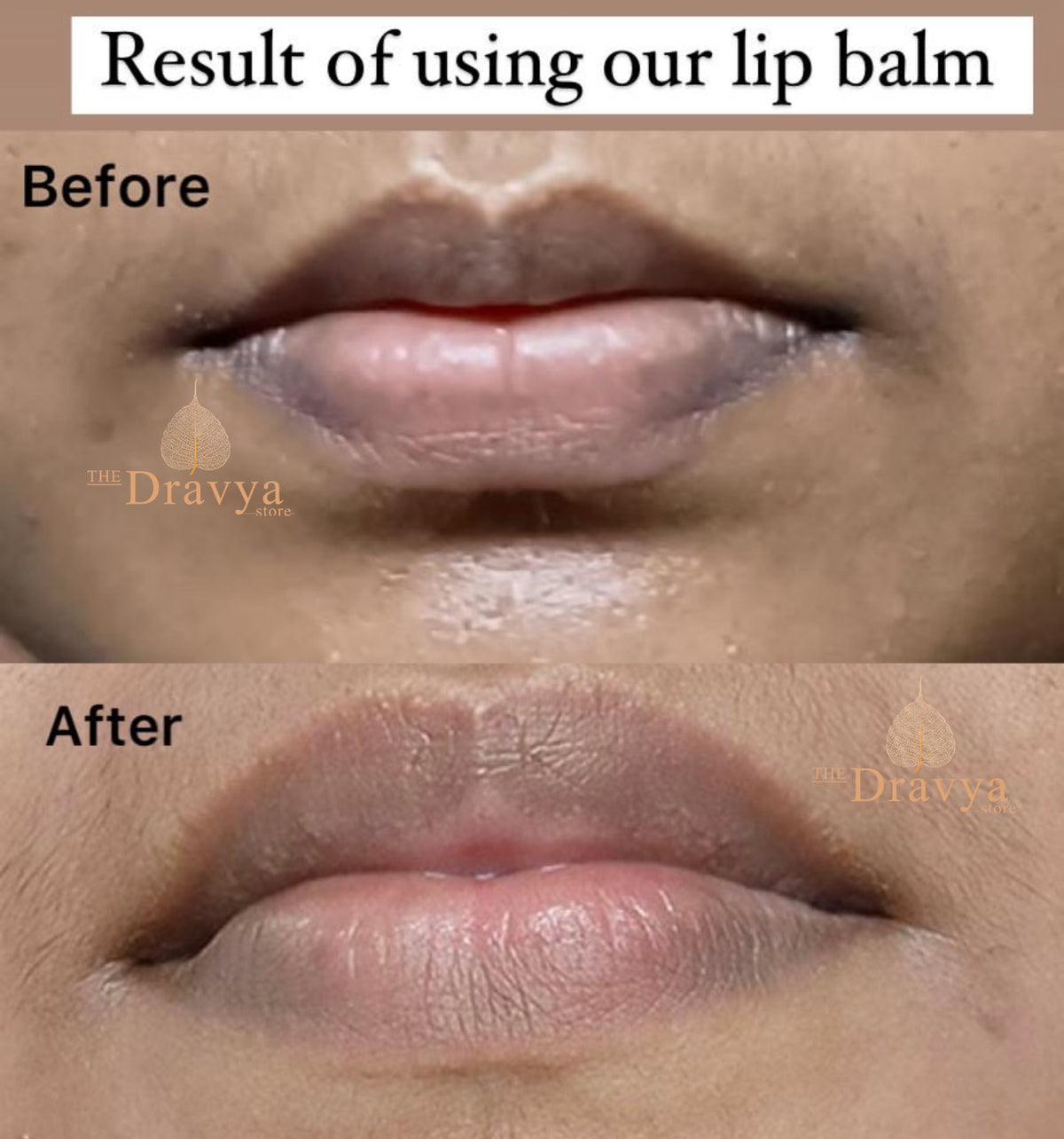 Rose Lip Balm - pigmented and dry lips