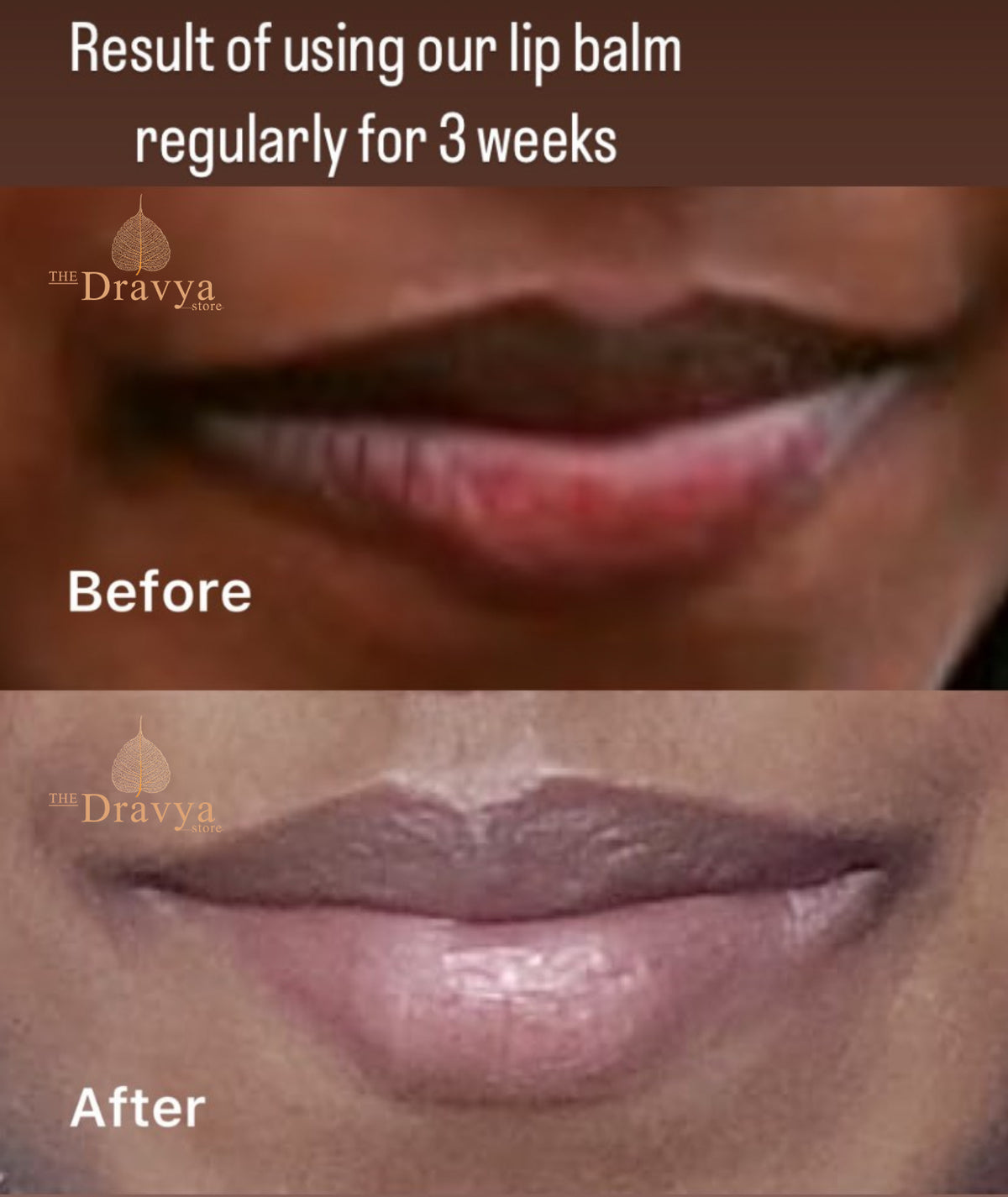 Rose Lip Balm - pigmented and dry lips